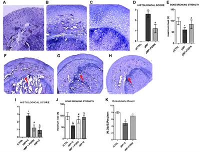 <mark class="highlighted">Adenosine Receptor</mark> Stimulation Improves Glucocorticoid-Induced Osteoporosis in a Rat Model